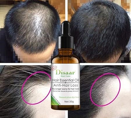 زيت عطري لعلاج تساقط الشعر بسرعة وكثافة